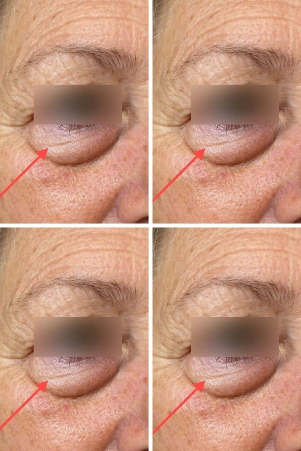These Changes Under Your Eyes May Be Trying to Tell You Something