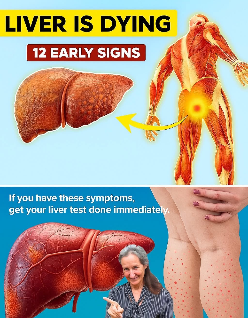 12 Early Warning Signs of Liver Cirrhosis You Should Never Ignore