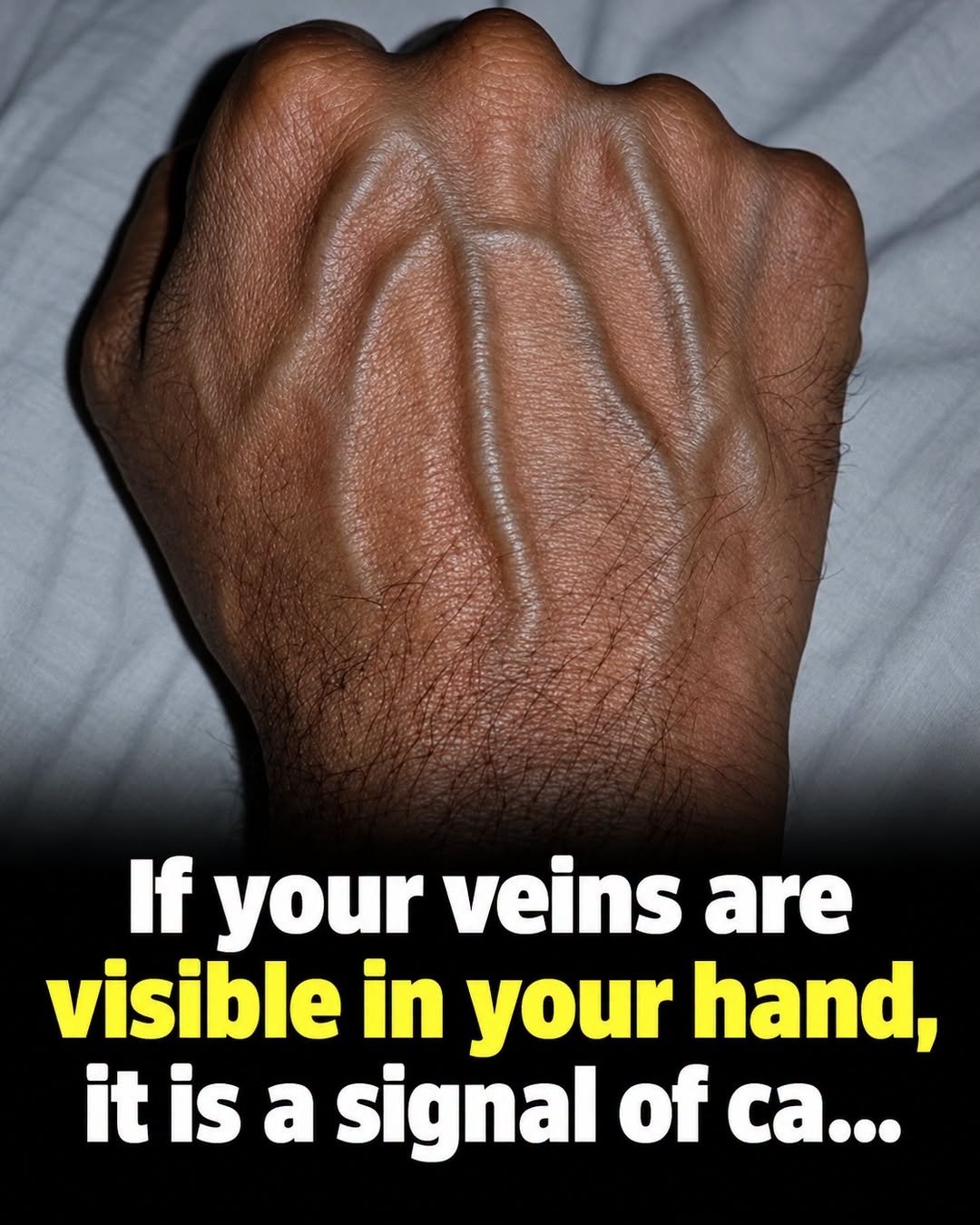 If the Veins in Your Hands Are Clearly Visible, What Does It Mean?