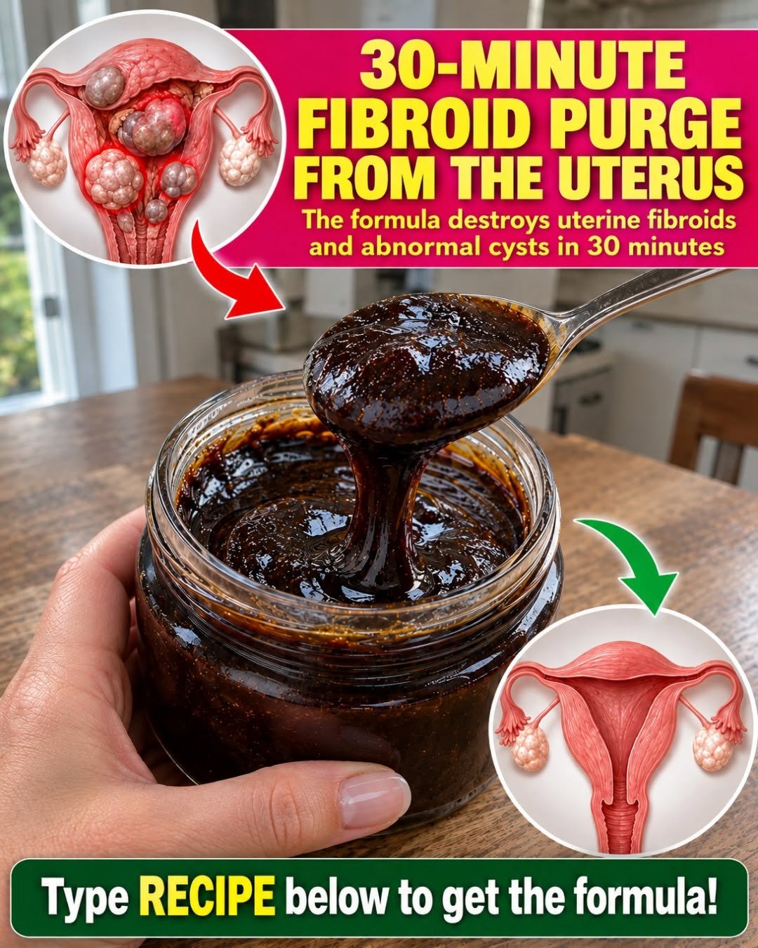 Uterine Fibroids and Ovarian Cysts: Natural Remedies, Symptoms, and Evidence-Based Treatment Options